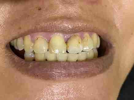 Image Source - Private dentist Maidenhead