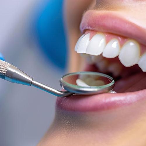 Apex Dental