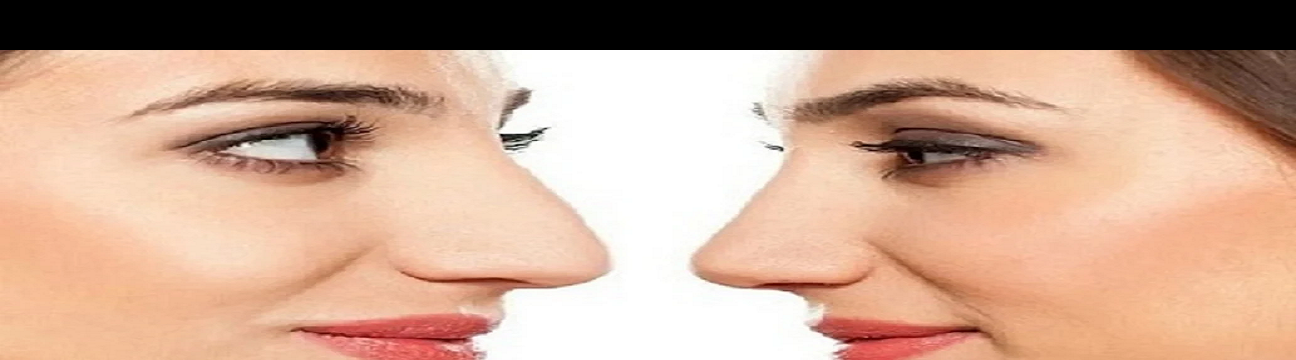 La Rinoplastica In Ospedale